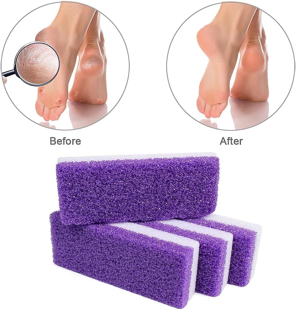 Foot Pumice Stone 4 Packs Set Double Sided Callus Remover Hard Skin and Dead Skin Scrubber Pedicure Tools for Foot Caring-Purple