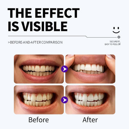 Professional Enamel-Safe Teeth Whitening Strips(12 Strips per Pack) - Antibacterial Gum Care & Deep Cleaning