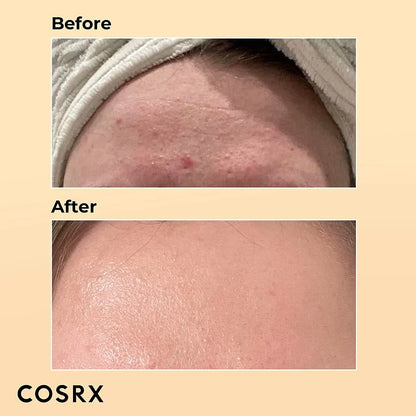 COSRX Advanced Snail 96 Mucin Power Essence - 100ml